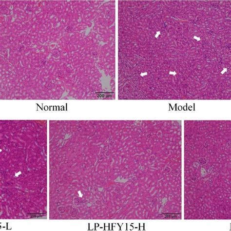 Hande Stained Sections Of Mouse Kidney Normal Injected With Normal