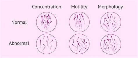 sperm test results explained interpretation and normal values