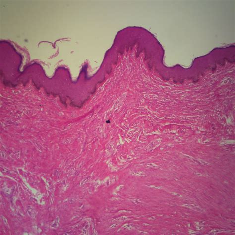 Human Heavily Pigmented Skin Sec 7 µm Hande Stain Microscope Slide