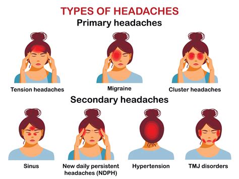 Types Of Headaches Vector Infographic Vector Art At Vecteezy