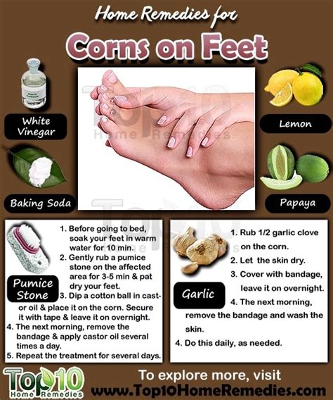 Home Remedies For Corns On Feet Top 10 Home Remedies