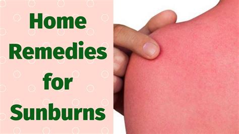 Home Remedies For Sunburns Quick Sunburn Relief Youtube