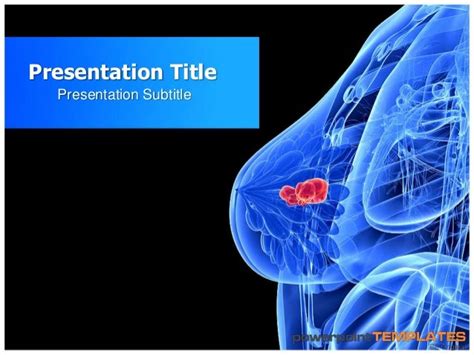 Powerpoint Presentation On Breast Cancer