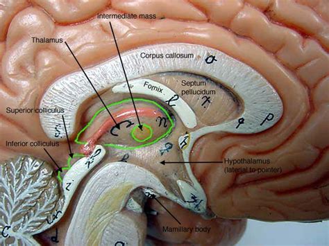 Serious games to learn anatomy. Pin by Michelle Neel on Anatomy lab 2 | Pinterest