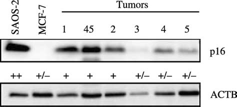 Pka has several functions in the cell, including regulation of glycogen, sugar, and lipid metabolism. Western blot analyses showing p16 protein levels in ...