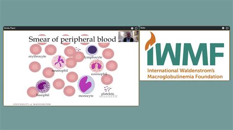2020 Iwmf Global Educational Webinar Understanding Your Blood And Bone