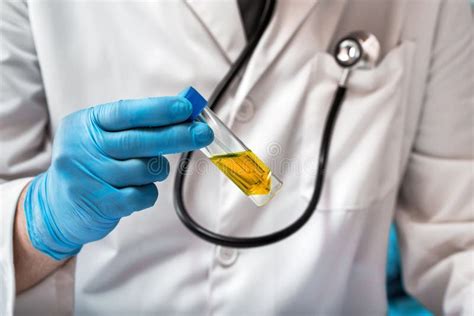 Physician With Urinalysis For Test Urea Examination Stock Photo Image