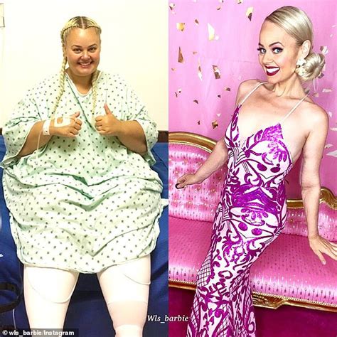 Barbie Obsessed Kayla Lavende 36 Shed A Staggering 90 Kilos Daily