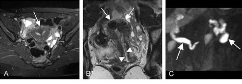 Figure 1 From Selective Visualization Of The Fallopian Tube With