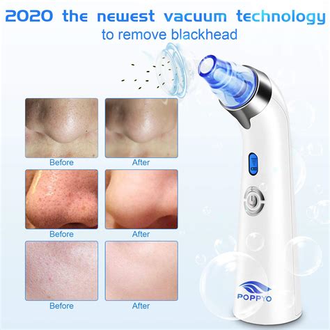Best Blackhead Remover On 2020 A Complete Buyers Guide