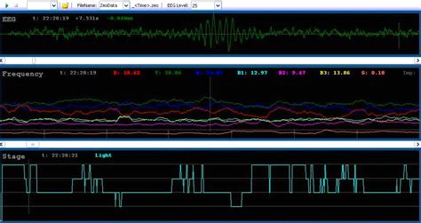 sleep: 32+ Sleep Spindles Example Pictures