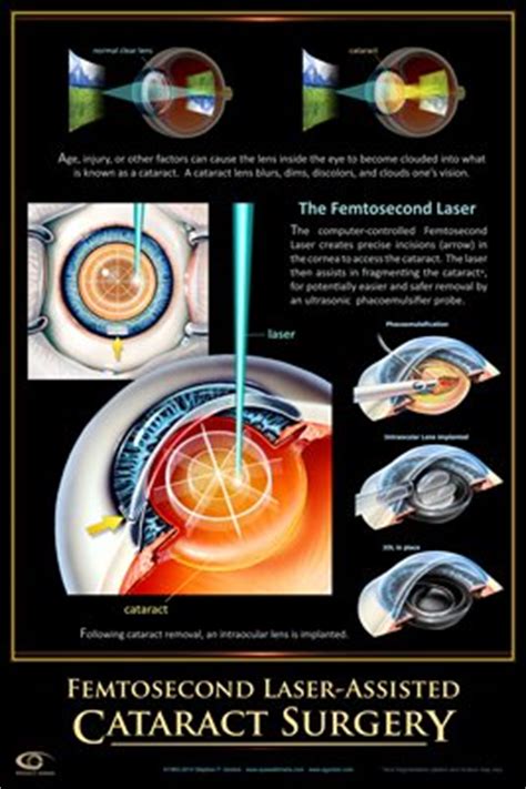collection eye wall charts magcloud