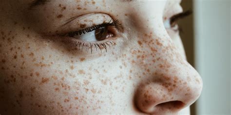 what are your freckles trying to tell you ny fashion review