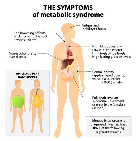 Have You Been Diagnosed With Metabolic Syndrome UF IFAS Extension Marion County