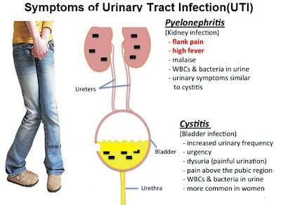 UTI Symptoms