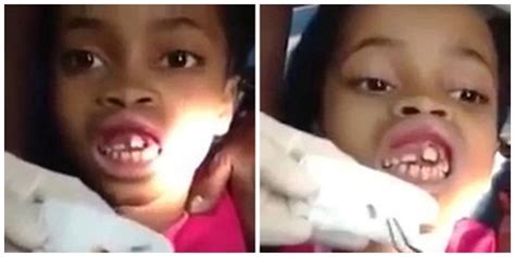 Shocked Dentist Removes 15 Life Maggots From Girls Mouth Video Photos Information Nigeria