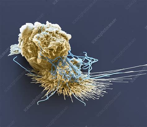 Macrophage Engulfing Bacteria Sem Stock Image C0066641 Science