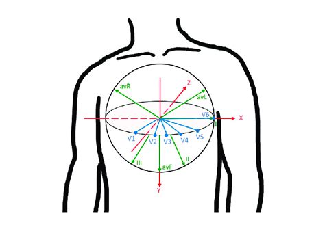 The Three Dimensional View Of 12 Ecg Leads On The Xyz Coordinate Axis