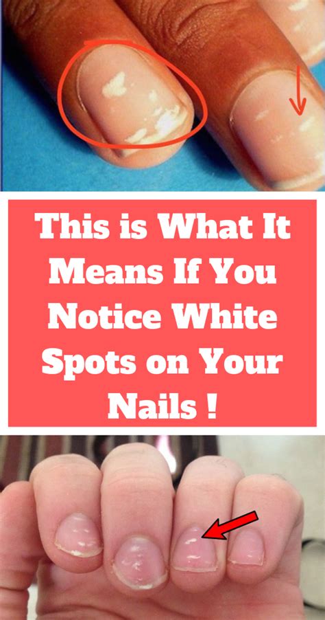 This Is What It Means If You Notice White Spots On Your Nails