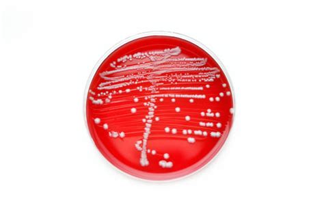 Klebsiella Photos Stock Photos Pictures And Royalty Free Images Istock