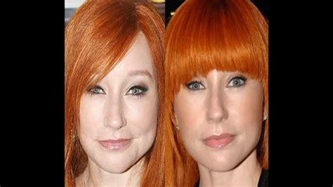 Tori Amos Plastic Surgery Before And After Pictures Youtube