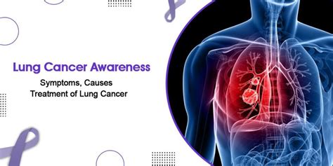 Main Symptoms Causes And Treatment Of Lung Cancer Canceronco