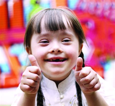 Children With Down Syndrome May Need More Screening For Sleep