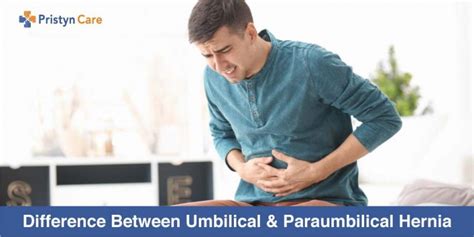 Difference Between Umbilical And Paraumbilical Hernia Pristyn Care