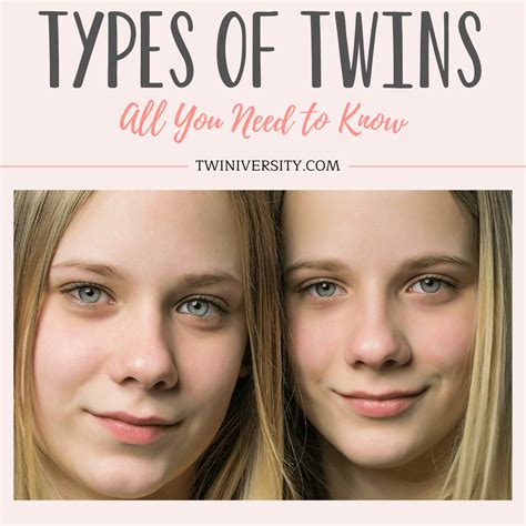 types of twins all you need to know twiniversity