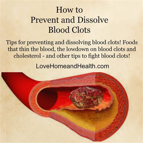 Treating Blood Clots Love Home And Health
