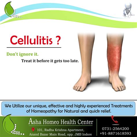 Cellulitis Asha Homeo Health Center Indore