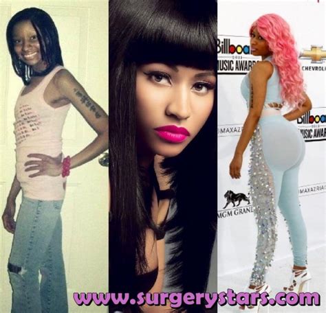 Nicki Minaj Butt Implants Before And After Pictures