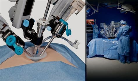 Da Vinci A Surgical Robot Conducts The First Ever Spinal Surgery