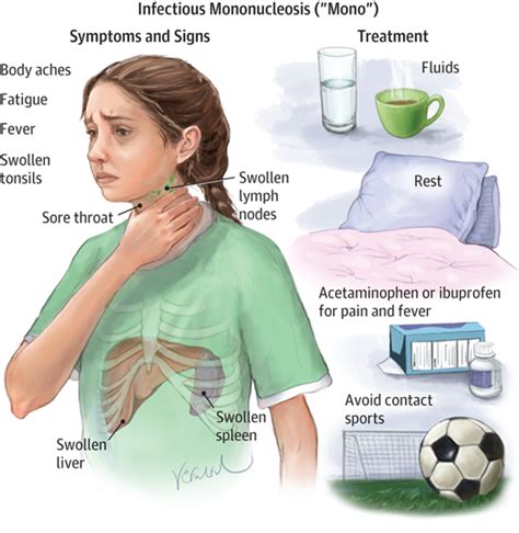 Symptoms Of Mononucleosis Include