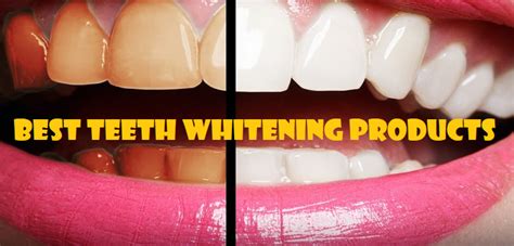 Sometimes, it's just not about using the best whitening lotion in the market. Top 10 Teeth Whitening Products : Best Teeth Whitening at ...