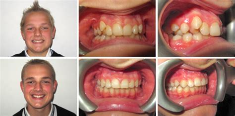 Moira Wong Orthodontics Kensington London Orthodontist