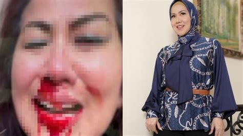 Pernah Pamer Kisah Hot Di Ranjang Ini Yang Bikin Ferry Irawan Aniaya Venna Melinda