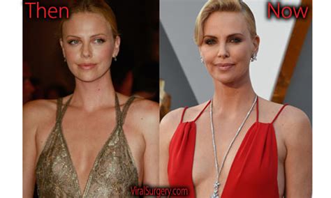 Charlize Theron Plastic Surgery Before And After Nose Job Pictures