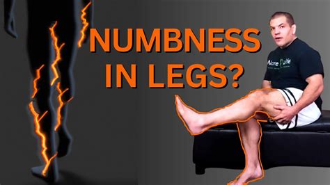 Numbness In Legs Causes And Treatment Youtube