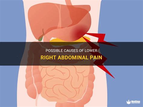 Possible Causes Of Lower Right Abdominal Pain MedShun