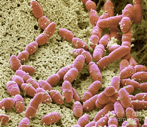 Streptococcus Mutans Photograph By Steve Gschmeissnerscience Photo Library