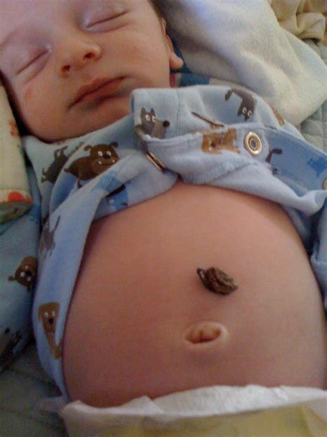 How to clean baby's belly button after umbilical cord falls off. Viva Cindy: Mateo: Week Three