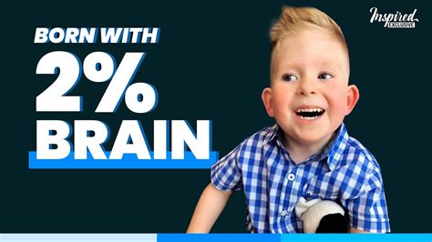 Noah Wall Boy Born Without A Brain Brain Miracle Child Amazing