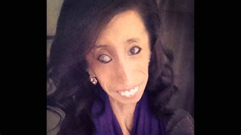 Most Beautiful Girl In The World Lizzie Velasquez Youtube