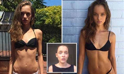 model who battled anorexia says she once weighed just 34 kilograms daily mail femail scoopnest