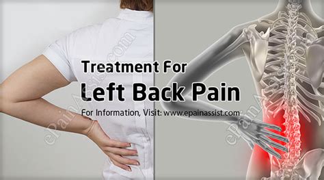 Left Back Painsymptomscausestreatmentprevention