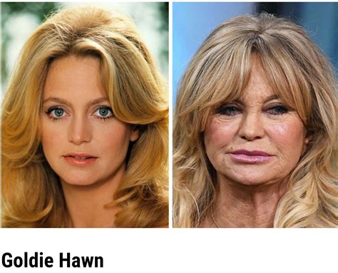 Jaclyn Smith S Plastic Surgery What Does The Actress Look Like Now