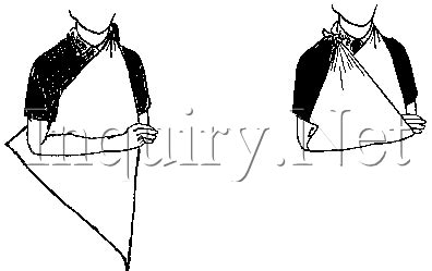 There is 1 long side, and 2 shorter sides of the bandage (triangle). Jlog: Scout Uniform