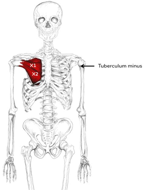 Subscapularis Muscle Pain And Trigger Points