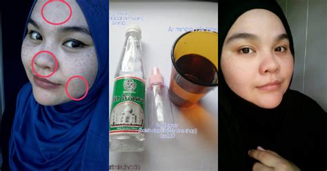 Masker tomat dan baking sodamasker tomatcara menghilangkan jerawat dan bekasnya yang pertama yaitu dengan menggunakan tomat sebagai masker wajah. Hilangkan Masalah Jeragat Degil Dengan Toner Air Mawar RM5 ...